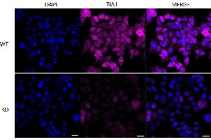 anti-TIA1 Cytotoxic Granule-Associated RNA Binding Protein (TIA1) antibody