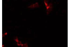 ABIN6266833 staining Hela by IF/ICC.