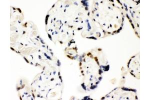 IHC analysis of SF2/SRSF1 using anti-SF2/SRSF1 antibody (ABIN3043296).