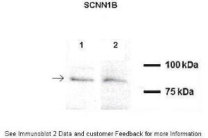 A549, H441 (SCNN1B antibody  (C-Term))