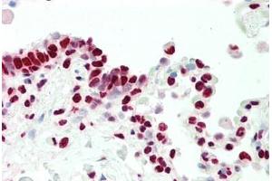 Human, Lung: Formalin-Fixed Paraffin-Embedded (FFPE) (NR2F6 antibody  (N-Term))