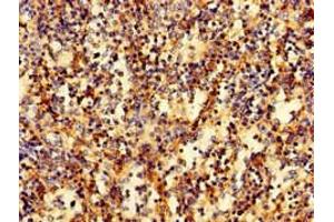 Immunohistochemistry of paraffin-embedded human spleen tissue using ABIN7167270 at dilution of 1:100 (RAB27A antibody  (AA 2-221))