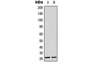 Western blot analysis of Adrenomedullin expression in MCF7 (A), mouse lung (B) whole cell lysates.