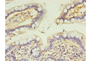 Immunohistochemistry of paraffin-embedded human small intestine tissue using ABIN7146497 at dilution of 1:100