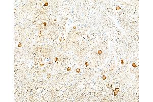 Immunohistochemistry (IHC) image for anti-Neurofilament, Light Polypeptide (NEFL) (AA 150-200) antibody (ABIN7453980)