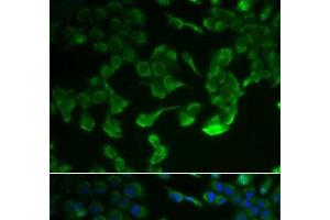 Immunofluorescence analysis of HeLa cells using C1R Polyclonal Antibody (C1R antibody)