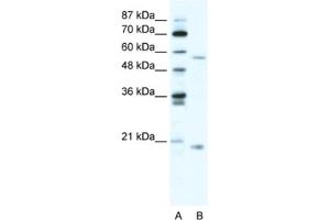 Western Blotting (WB) image for anti-Zinc Finger Protein 18 (ZNF18) antibody (ABIN2460737)