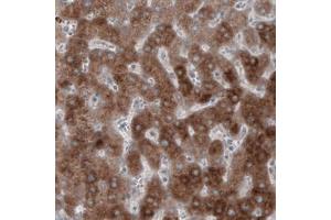 Immunohistochemical staining (Formalin-fixed paraffin-embedded sections) of human liver with HMGCR monoclonal antibody, clone CL0259  shows strong cytoplasmic immunoreactivity.