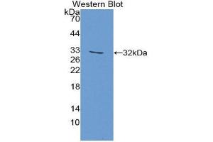 Western Blotting (WB) image for anti-Fatty Acid Synthase (FASN) (AA 2243-2505) antibody (ABIN1858805) (Fatty Acid Synthase antibody  (AA 2243-2505))