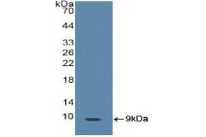 Detection of Recombinant BRCA1, Human using Polyclonal Antibody to Breast Cancer Susceptibility Protein 1 (BRCA1)