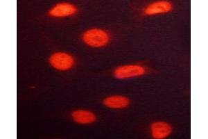ABIN6267691 staining HeLa cells by ICC/IF. (RACGAP1 antibody  (pSer387))