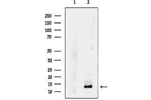 anti-Ubiquinol-Cytochrome C Reductase Binding Protein (UQCRB) (N-Term) antibody
