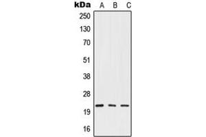 Western blot analysis of IFN beta expression in HepG2 (A), mouse liver (B), rat liver (C) whole cell lysates. (IFNB1 antibody  (Center))