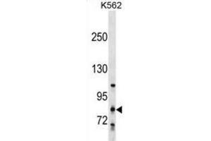 Western Blotting (WB) image for anti-Glycosyltransferase 25 Domain Containing 2 (GLT25D2) antibody (ABIN2999969)