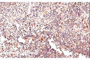 ABIN185585 (4µg/ml) staining of paraffin embedded Human Lymph Node. (GLI2 antibody  (Internal Region))