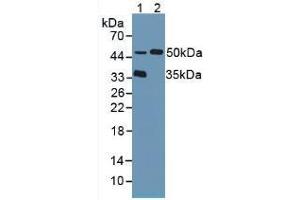 Figure. (TPP1 antibody  (AA 1-320))