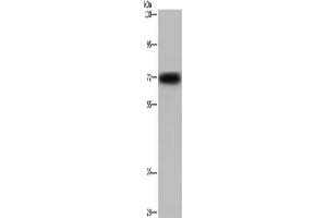 Gel: 6 % SDS-PAGE, Lysate: 40 μg, Lane: Mouse heart tissue, Primary antibody: ABIN7129956(KCND3 Antibody) at dilution 1/700, Secondary antibody: Goat anti rabbit IgG at 1/8000 dilution, Exposure time: 30 seconds
