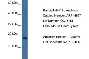 WB Suggested Anti-Pnkd Antibody   Titration: 1. (PNKD antibody  (N-Term))