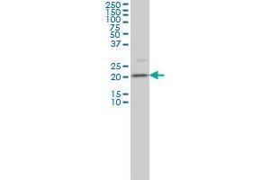 TAGLN3 monoclonal antibody (M01), clone 1D2 Western Blot analysis of TAGLN3 expression in IMR-32 . (Transgelin 3 antibody  (AA 1-199))