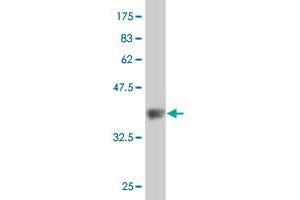 Western Blot detection against Immunogen (38. (SKIV2L antibody  (AA 1125-1233))