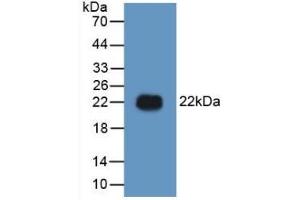 Detection of Recombinant HMG1, Human using Polyclonal Antibody to High Mobility Group Protein 1 (HMGB1) (HMGB1 antibody  (AA 9-163))