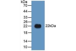 Detection of Recombinant HMG1, Human using Polyclonal Antibody to High Mobility Group Protein 1 (HMGB1)