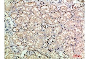 Immunohistochemical analysis of paraffin-embedded human-kidney, antibody was diluted at 1:200 (Selectin E/CD62e antibody)
