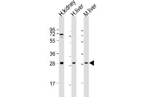 All lanes : Anti-SIRT3 Antibody (C-term) at 1:2000 dilution Lane 1: human kidney lysate Lane 2: human liver lysate Lane 3: mouse liver lysate Lysates/proteins at 20 μg per lane. (SIRT3 antibody  (C-Term))