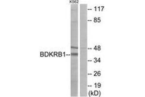 Western blot analysis of extracts from K562 cells, using BDKRB1 Antibody.