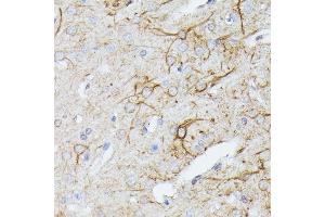 Immunohistochemistry of paraffin-embedded rat brain using TBCA antibody (ABIN6131384, ABIN6148884, ABIN6148885 and ABIN6216894) at dilution of 1:100 (40x lens). (TBCA antibody  (AA 1-108))