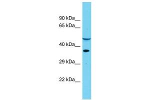 Host: Rabbit Target Name: DUS4L Sample Type: Placenta lysates Antibody Dilution: 1. (DUS4L antibody  (Middle Region))