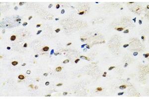 Immunohistochemistry of paraffin-embedded Rat brain using SFPQ Polyclonal Antibody at dilution of 1:100 (40x lens). (SFPQ antibody)