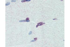 Immunohistochemistry (IHC) image for anti-PR Domain Containing 9 (PRDM9) (Middle Region) antibody (ABIN2774963) (PRDM9 antibody  (Middle Region))