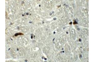 Immunohistochemical staining of mouse brain cells with RABGEF1 polyclonal antibody  at 5 ug/mL. (RABGEF1 antibody  (Internal Region))