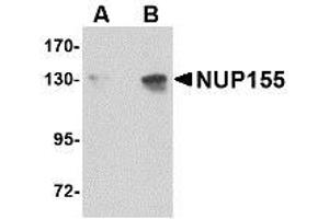 Image no. 1 for anti-Nucleoporin 155kDa (NUP155) (C-Term) antibody (ABIN342687) (NUP155 antibody  (C-Term))