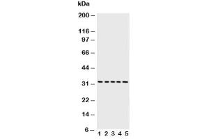 Western blot testing of Caspase-6 antibody and Lane 1:  MCF-7