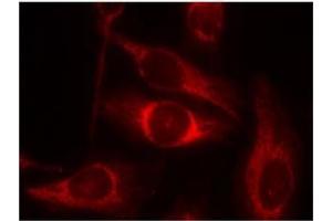 Image no. 2 for anti-Tumor Protein P53 (TP53) (pSer46) antibody (ABIN196787) (p53 antibody  (pSer46))