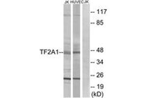 Western blot analysis of extracts from Jurkat/HuvEc cells, using TF2A1 Antibody. (GTF2A1 antibody  (AA 281-330))