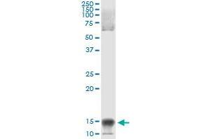 Immunoprecipitation of NFATC2IP transfected lysate using anti-NFATC2IP monoclonal antibody and Protein A Magnetic Bead , and immunoblotted with NFATC2IP MaxPab rabbit polyclonal antibody. (NFATC2IP antibody  (AA 1-138))