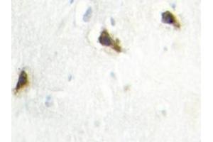 Image no. 2 for anti-Histidyl-tRNA Synthetase (HARS1) antibody (ABIN272164) (HARS1/Jo-1 antibody)