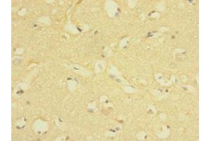 Immunohistochemistry of paraffin-embedded human brain tissue using ABIN7158206 at dilution of 1:100 (Lrig1 antibody  (AA 35-220))
