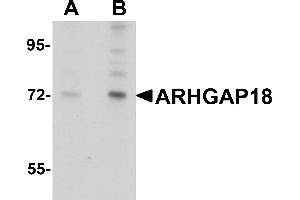 Western Blotting (WB) image for anti-rho GTPase Activating Protein 18 (ARHGAP18) (C-Term) antibody (ABIN1030254) (ARHGAP18 antibody  (C-Term))
