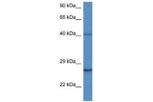 Western Blot showing CCS antibody used at a concentration of 1 ug/ml against MDA-MB-435S Cell Lysate (Superoxide dismutase copper chaperone antibody  (C-Term))