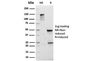 SDS-PAGE Analysis Purified NKX3. (NKX3-1 antibody  (AA 92-224))