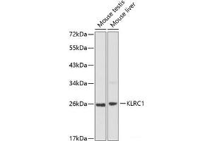 Western blot analysis of extracts of various cell lines using KLRC1 Polyclonal Antibody at dilution of 1:1000. (KLRC1 antibody)