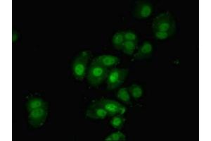 Immunofluorescent analysis of MCF-7 cells using ABIN7142338 at dilution of 1:100 and Alexa Fluor 488-congugated AffiniPure Goat Anti-Rabbit IgG(H+L) (PDPK1 antibody  (AA 277-556))