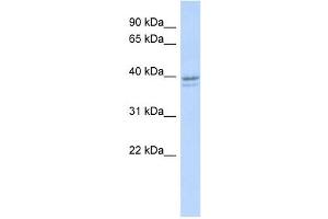 RRM2 antibody used at 1 ug/ml to detect target protein. (RRM2 antibody  (N-Term))