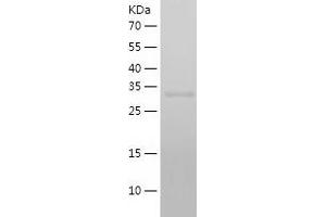 Western Blotting (WB) image for Vacuolar Protein Sorting-Associated Protein 26A (VPS26A) (AA 1-327) protein (His tag) (ABIN7284605) (VPS26A Protein (AA 1-327) (His tag))