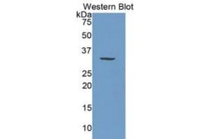 WB of Protein Standard: different control antibodies against Highly purified E. (PML ELISA Kit)