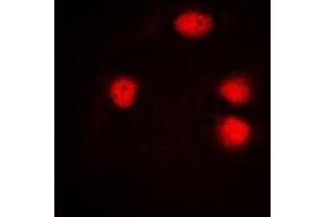 Immunofluorescent analysis of ELF5 staining in HuvEc cells. (ELF5 antibody  (C-Term))
